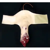 Techline Technologies Full Leg Amputation