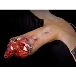 Techline Technologies Full Leg Amputation
