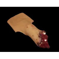 Techline Technologies Full Leg Amputation