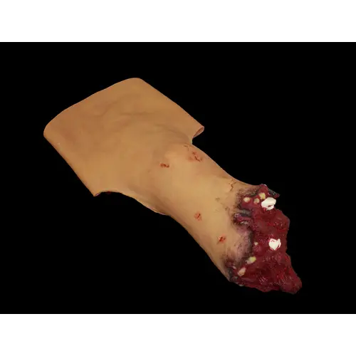 Techline Technologies Full Leg Amputation