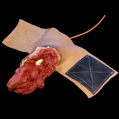 Techline Technologies Full Arm Amputation