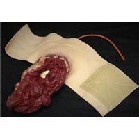 Techline Technologies Full Arm Amputation