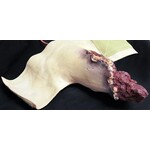 Techline Technologies Full Arm Amputation