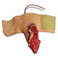 Techline Technologies Full Arm Amputation