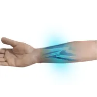 Techline Technologies Closed Right Arm Fracture