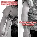 Techline Technologies Closed Right Arm Fracture