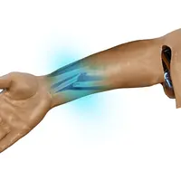 Techline Technologies Closed Right Arm Fracture