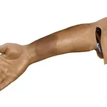 Techline Technologies Closed Right Arm Fracture