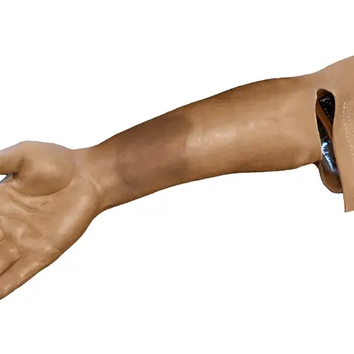 Techline Technologies Closed Right Arm Fracture
