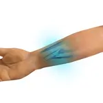 Techline Technologies Closed Right Arm Fracture