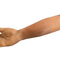 Techline Technologies Closed Right Arm Fracture