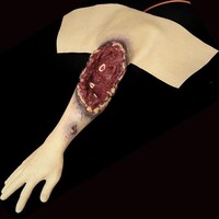 Techline Technologies Partial Right Arm Amputation