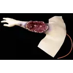 Techline Technologies Partial Right Arm Amputation