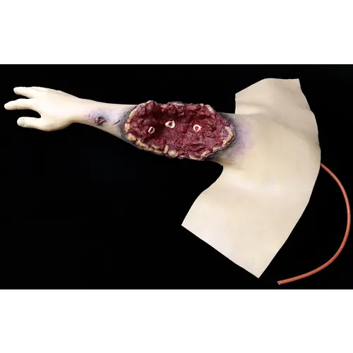 Techline Technologies Partial Right Arm Amputation