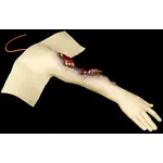 Techline Technologies Partial Right Arm Amputation