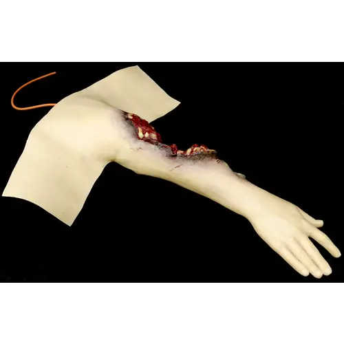 Techline Technologies Partial Right Arm Amputation