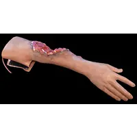 Techline Technologies Partial Right Arm Amputation