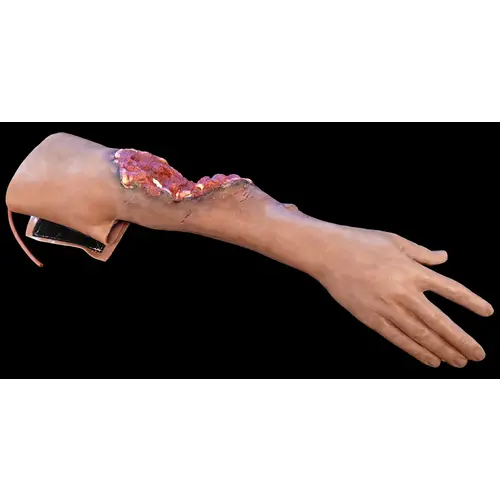 Techline Technologies Partial Right Arm Amputation