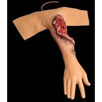 Techline Technologies Partial Right Arm Amputation