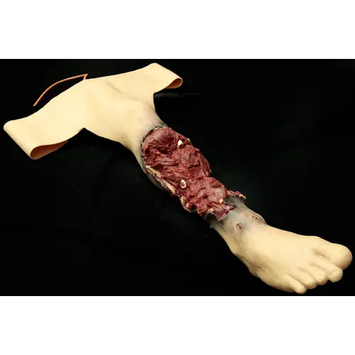 Techline Technologies Partial Right Leg Amputation