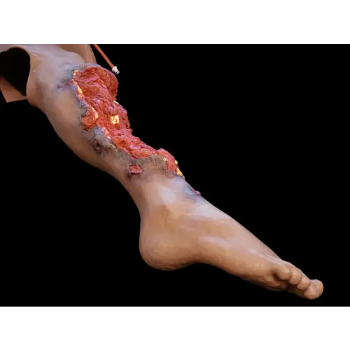 Techline Technologies Partial Right Leg Amputation