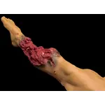 Techline Technologies Partial Right Leg Amputation