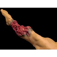 Techline Technologies Partial Right Leg Amputation