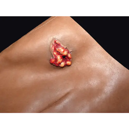 Techline Technologies GSW to Female Groin