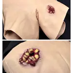 Techline Technologies GSW to Female Groin