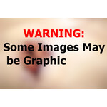 Techline Technologies GSW to Male Groin
