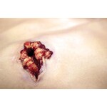 Techline Technologies GSW to Male Groin