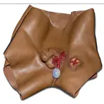 Techline Technologies GSW to Male Groin