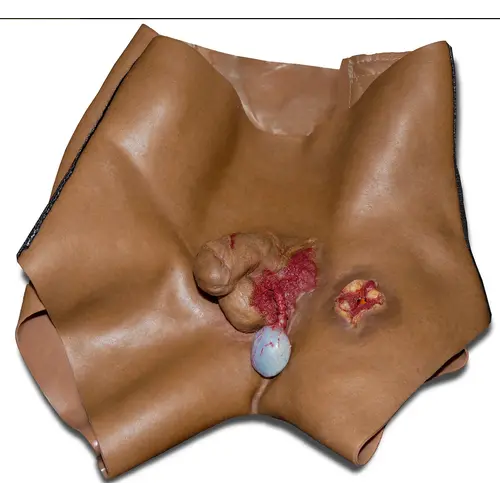 Techline Technologies GSW to Male Groin