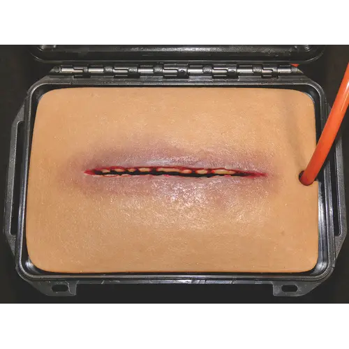Techline Technologies Wound Packing Sim2 Kit