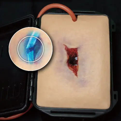 Techline Technologies Wound Packing Sim3 Kit
