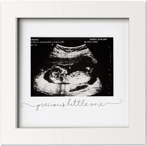 KeaBabies KeaBabies - Baby Sonogram Picture Frame