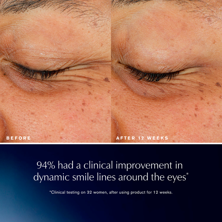 Estee Lauder Estee Lauder Advanced Night Repair Eye Lift + Sculpt