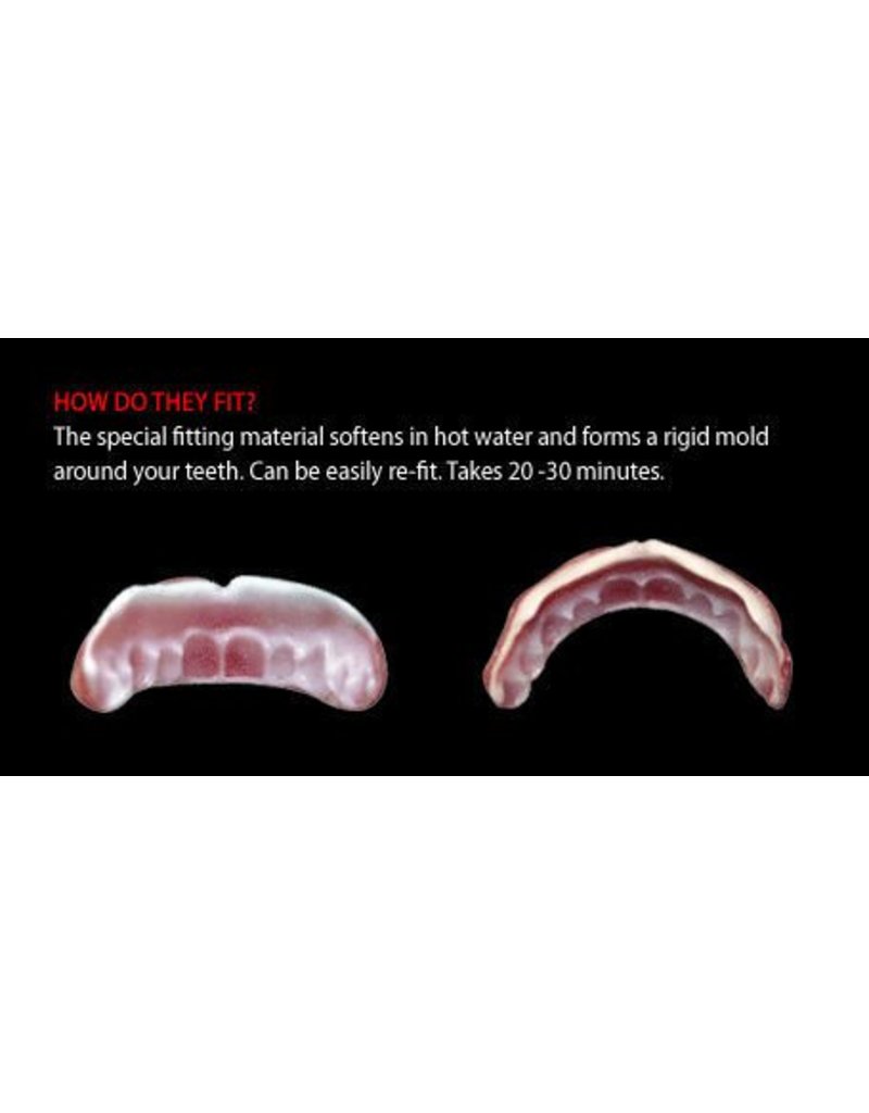 Dental Distortions Hyde Fx Fangs