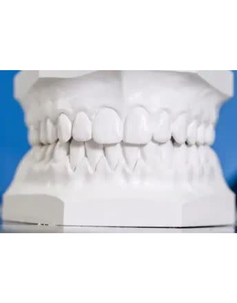 USG Dental Impression Plaster