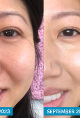 MooGoo MooGoo Amplified Anti-Ageing Peptide Active Serum with Argireline 25ml