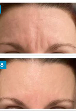 MooGoo MooGoo Amplified Anti-Ageing Peptide Active Serum with Argireline 25ml