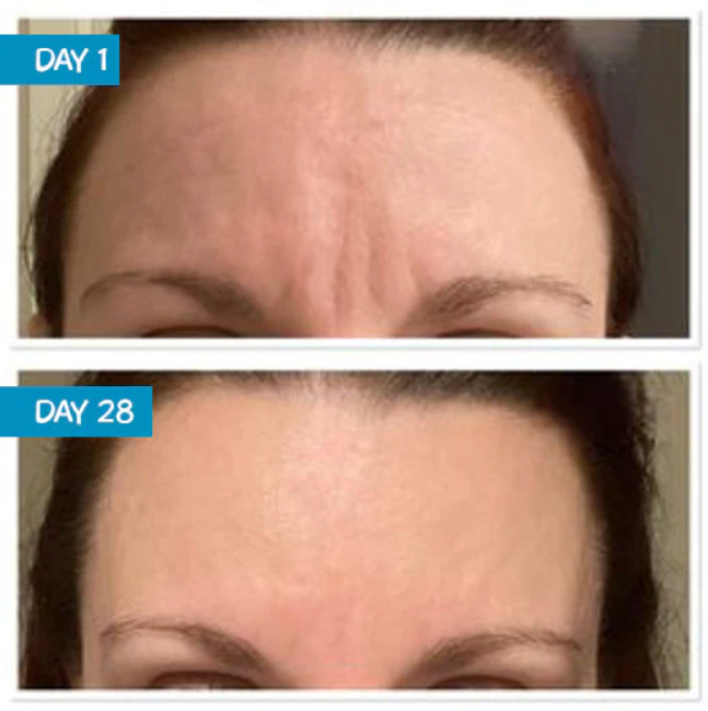 MooGoo MooGoo Amplified Anti-Ageing Peptide Active Serum with Argireline 25ml