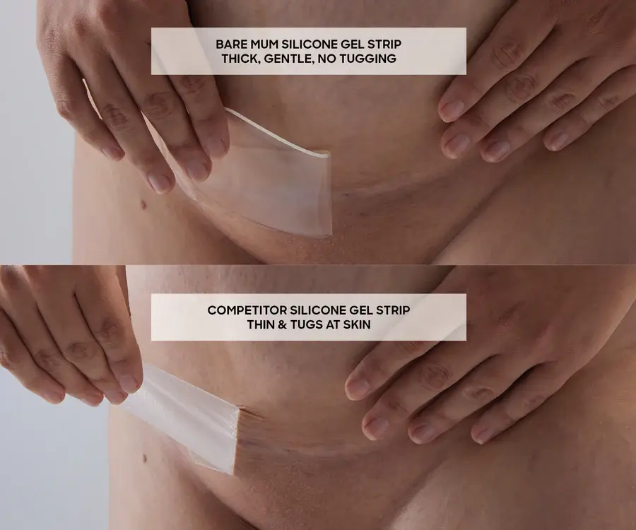 Bare Mum Bare Mum Silicone Gel Scar Strips