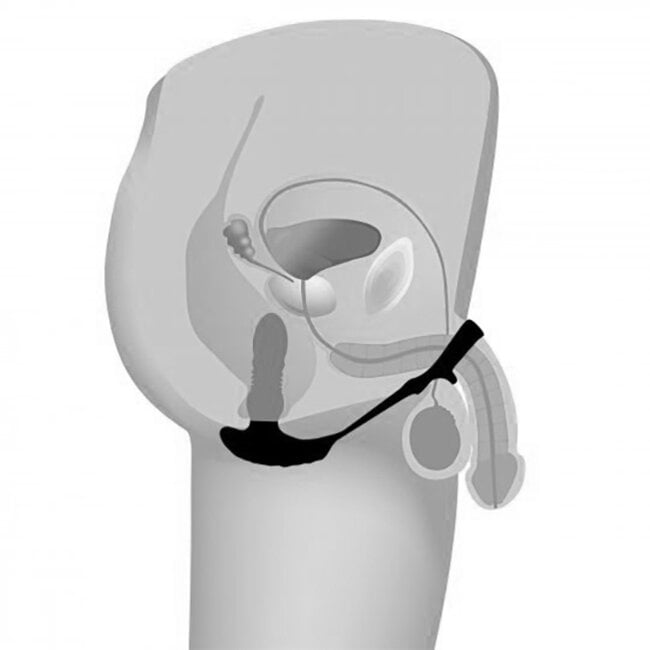 Thunderplugs 10X Thrusting Plug