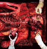 200 Stab Wounds - Manual Manic Procedures (Plutonium Green & Yellow Marbled)