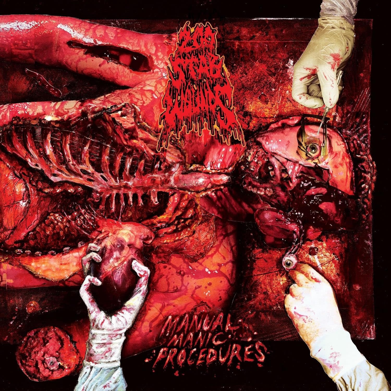 200 Stab Wounds - Manual Manic Procedures (Plutonium Green & Yellow Marbled)