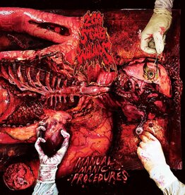 200 Stab Wounds - Manual Manic Procedures (Plutonium Green & Yellow Marbled)