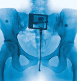 Lorde - Virgin (Blood)