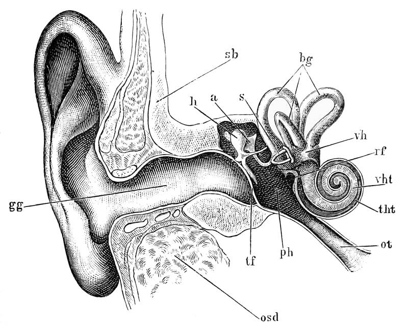 Surfer's Ear - Yep, It's Real