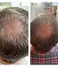Agent Nateur holi (growth) 84 advanced leave-in growth scalp treatment